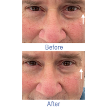Load image into Gallery viewer, Dr. Susan Spell 2-Minute InstaLift Wrinkle Reducer 15 mL