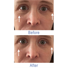 Load image into Gallery viewer, Dr. Susan Spell 2-Minute InstaLift Wrinkle Reducer 15 mL