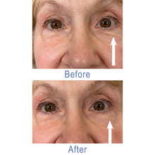 Load image into Gallery viewer, Dr. Susan Spell 2-Minute InstaLift Wrinkle Reducer 15 mL