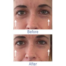 Load image into Gallery viewer, Dr. Susan Spell 2-Minute InstaLift Wrinkle Reducer 15 mL