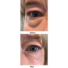 Load image into Gallery viewer, Dr. Susan Spell 2-Minute InstaLift Wrinkle Reducer 15 mL