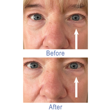 Load image into Gallery viewer, Dr. Susan Spell 2-Minute InstaLift Wrinkle Reducer 15 mL